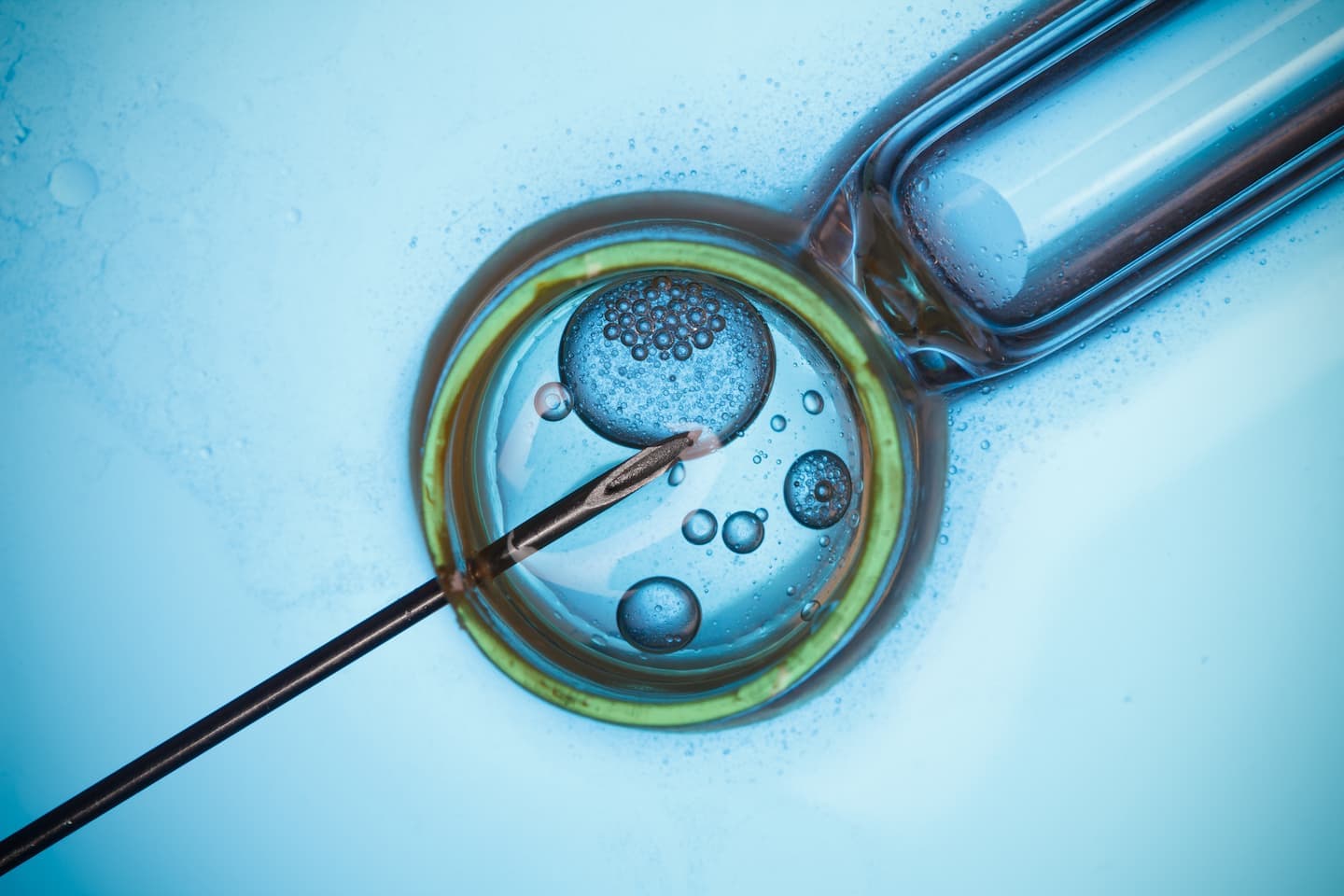 Cooper Surgical IVF Fluid